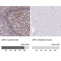 Lamin B Receptor Antibody, Novus Biologicals 25 &mu;L, Unlabeled:Antibodies,
